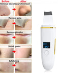 Ultrasonic Skin Scrubber: Facial Cleansing