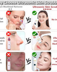 Ultrasonic Skin Scrubber: Facial Cleansing