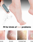 Electric Foot File Callus Remover